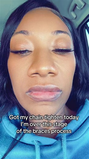 #creatorsearchinsights Color change today #braces