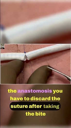 7 Managing Arterial Anastomosis with Precision Techniques 🔍 #medicalyoutube #surgeryfortrainees
