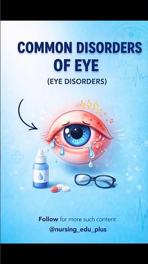 Common Disorders of Eye | Nursing & Medical Quick Revision 👁️ | Adult Health Nursing !!