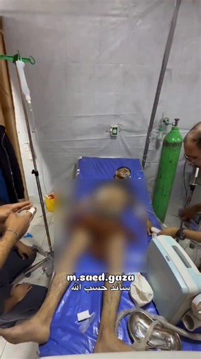 ‎🇵🇸 عين على فلسطين | Eye on Palestine‎ on Instagram‎: "A critical chest injury after random gunfire from Israeli military vehicles following a sudden incursion near Kuwait Roundabout in the Al-Zeitoun neighborhood, east of Gaza City. إصابة خطـ ـيرة في الصدر جراء إطلاق نار عشوائي من آليات الاحـ ـتلال عقب توغل مفاجئ قرب دوار الكويت في حي الزيتون شرق مدينة غـ ـزة."‎