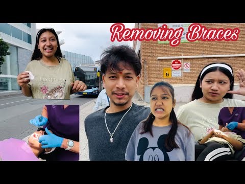 Finally Removing my Braces After 20 Months! 😁 | Braces Off Transformation