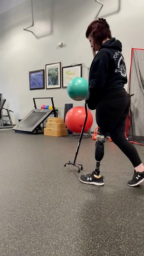 Introducing Dee Dee, an above knee amputee and Shamrock’s first patient to undergo osseointegration surgery! ☘️ Osseointegration is a transformative procedure for amputees that involves the anchoring of a metal implant into the existing bone. The OPRA Implant System by Integrum Inc makes mobility possible for patients who are unable to utilize a conventional socket prosthesis. For Dee Dee, choosing an osseointegration system benefitted her by providing seamless attachment, and while Dee Dee’s ca