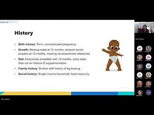 Understanding Bone Health in Children Pediatric Grand Rounds 5 9 25 Meeting Recording