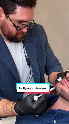Hollywood Jawline ↓ → A defined jawline isn’t about exaggeration. It’s about structure, balance, and masculine proportions. This Hollywood Jawline treatment is designed to enhance the mandibular line, improve facial angles, and bring harmony to the lower face—always respecting each patient’s anatomy. Results are subtle, natural, and tailored. No overfilling. No one-size-fits-all. If you’re looking for a sharper profile with a medical approach and aesthetic criteria, this treatment may be for you