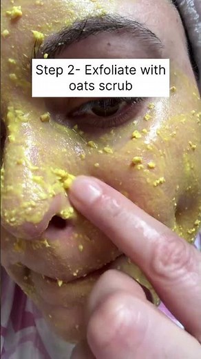 “Remove Whiteheads Naturally 🌿 Easy Skincare Routine at Home” ‪@Glowfromwithin.journey‬