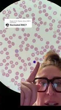 Reese Jitters MD In a peripheral blood smear, a nucleated red blood cell (NRBC) appears distinct due