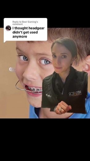 Understanding Different Types of Orthodontic Headgear