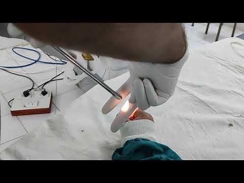 RIGID ESOPHAGOSCOPY DEMO