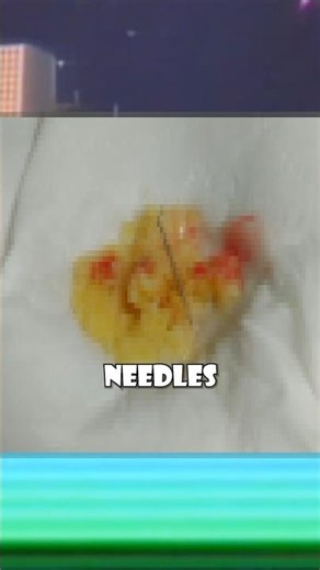 The Undertale Needle Cookie Incident