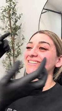 #dissolving #filler #hylenex