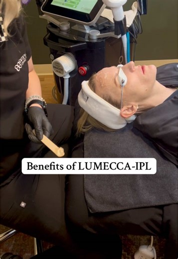 Lumecca IPL by InMode is the ultimate skin-perfecting treatment! It is the most powerful intense pulsed light to treat pigmented and vascular lesions. What are the benefits? In 1-3 sessions Lumecca improves the appearance of: ☀️ Sun Damage ❣️Redness 🟤 Pesky pigmentation 🕷️ Veins, Telangiectasia 👵🏼👴🏼 Age Spots Most areas can be treated—the most common includes face, neck, décolletage, legs, hands, and arms. Patients notice significant improvements of their skins complexion and clarity after