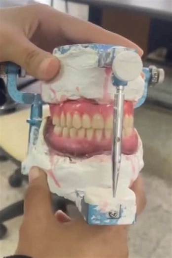 complete denture #dentist #الشعب_الصيني_ماله_حل😂😂 #اكسبلورexplore #fby #جامعة_القدس_ابوديس #جامعة_القدس_ابو_ديس