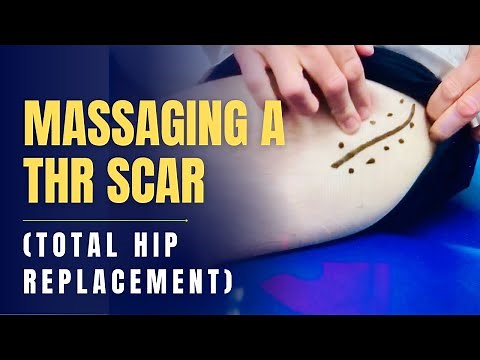 Massage Over Total Hip Replacement THR Scar