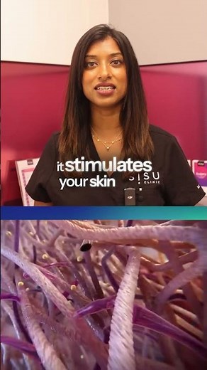 How Does Sculptra Actually Work? A Doctor Explains