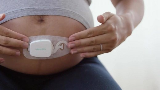 324K views · 540 shares | See every contraction happen with the Bloomlife tracker and app. Rent during pregnancy; return when baby is born. Try Bloomlife FREE for 7 days. | Bloomlife | Facebook