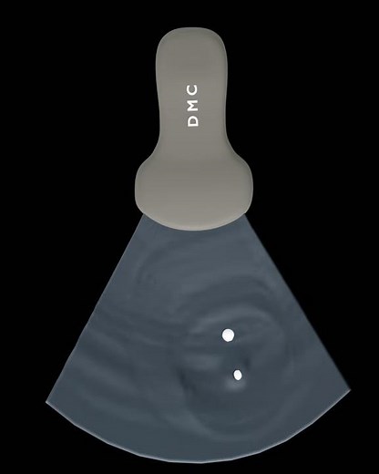 Ultrasound beam axial resolution simulation