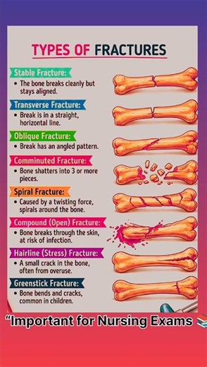 All Fracture Types One Shot Revision 🦴