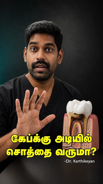 கேப்க்கு அடியில் சொத்தை வருமா? - Decay Under RCT Crown! | Dr. Karthikeyan | Denta Kings