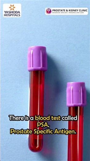 Prostrate cancer tests #drgopichandm