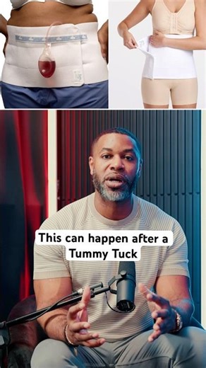 After a tummy tuck, fluid buildup (seroma) can happen #DrTriggs #TummyTuck