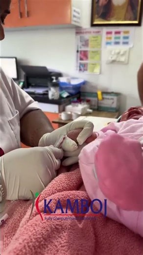 Venepuncture vs Heel Prick in Term Neonates