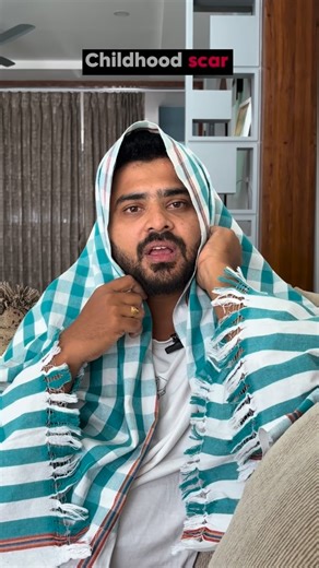 @guru_pranav on Instagram: "Childhood Scars are so beautiful right? 🥰❤️ Mention your childhood scar experiences in the comment section and listen to mine till end of the video 😂🙈🤷🏻‍♂️ #childhood #child #mom #content #gurupranav [Childhood, Scar, Mom, Dad, Friend, Comedy, Funny, Meme]"