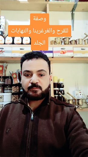 ‎كوزمتك المصطفى‎ on Instagram‎: "اصحاب الفرح والجروح"‎