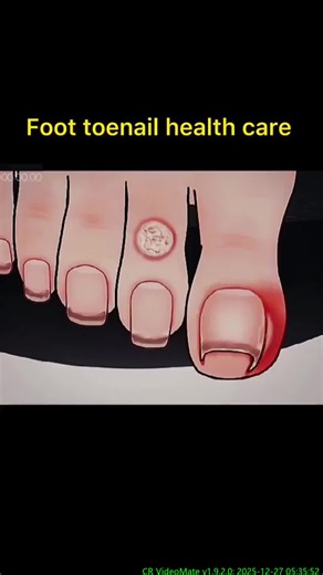 Comprehensive Guide to Dental Tartar Cleaning