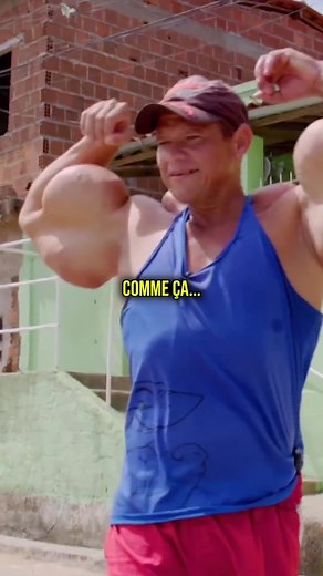 Synthol et musculation : produits et risques