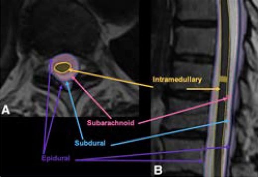 45K views · 201 reactions | #spine #disease #MRI | CT Scan and MRI study | Facebook
