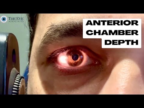 Anterior Chamber Depth