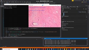 Breast cancer classification using Tensorflow and OpenCV