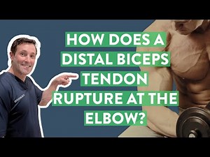 How does a distal biceps tendon rupture at the elbow occur?