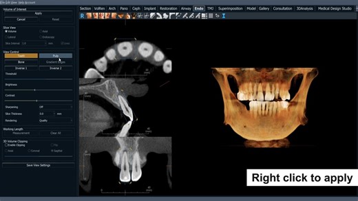Training： The Invivo Endo Tab