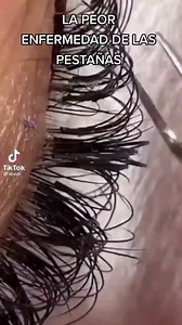 Hola, mi nombre es demodex folliculorum y vivo en los poros de la piel de tu rostro, por eso es importante lavarte la cara y quitarte el maquillaje. La única forma en que puedes verme es con un microscopio. Mido entre 0,3 y 0,4 mm, y como las arañas, tengo 8 patas. Me gusta vivir en los folículos pilosos que tienen tu nariz, mejilla y pestañas. Estos son lugares donde hay más grasa para alimentarme. Me alimento de tus secreciones y de tu piel muerta. Puedo poner hasta 25 huevos en cada folículo 