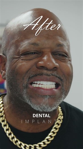 Xcell Dental Implants: Before & After Transformation