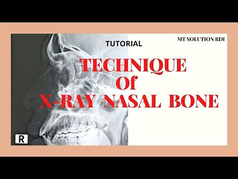 Technique of x ray nasal bone (Ep-28) |Nasal bone lateral view positioning | Bangla tutorial