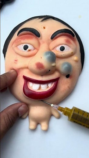 Most Satisfying Pimple Pops You’ll See Today 🤯