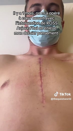 Dernier pansement après opération cœur ouvert