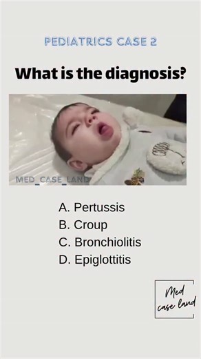 Med Case Land | Comment below👇 Follow for more✨ (Answer in the comments) #medicalstudent #medicine #ortho #usmle #plab #mbbs#mednotes #orthopedics... | Instagram