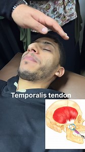 #tmj muscles palpitation #physiotherapy #ptc #viralvideochallenge | Youssef Waly