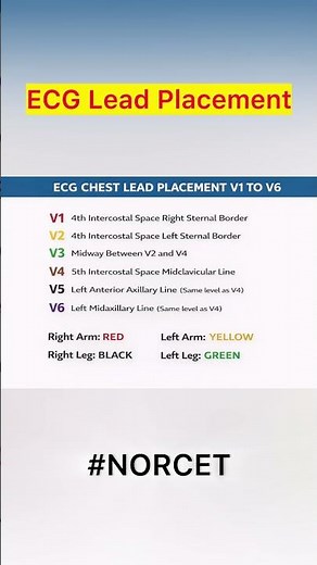 “ECG Lead Placement Made Easy ⚡ | NORCET Most Asked Topic”