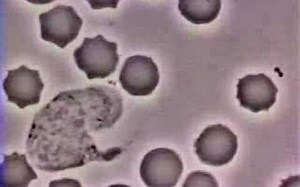 [Vidéo] Comment le globule blanc court après une bactérie dans notre corps - L-FRII