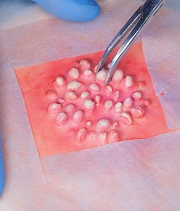 1M views · 1.4K reactions | Medizinische HACKEN und Behandlungen von Profis! | 5-Minuten Tricks Familie | Facebook