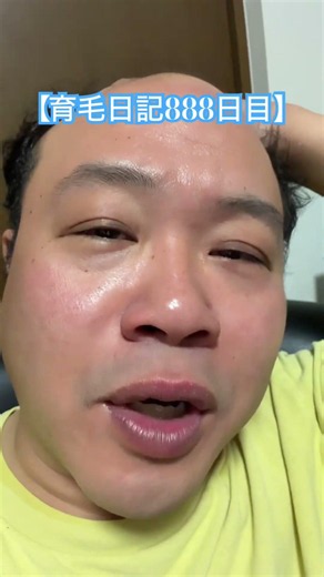 [Hair Growth Diary Day 888] Is this the finale?? #Let'sPlay #Diary #HairGrowth