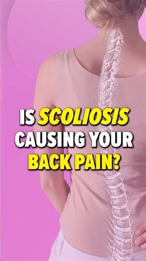 Scoliosis in Teens Explained | A Common Cause of Back Pain