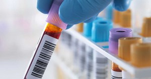 Taux de triglycérides élevé = cholestérol ?