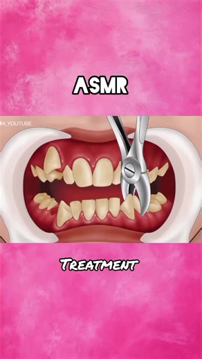 #asmrtreatment #asmr #relaxingasmr #tiktok #fyp