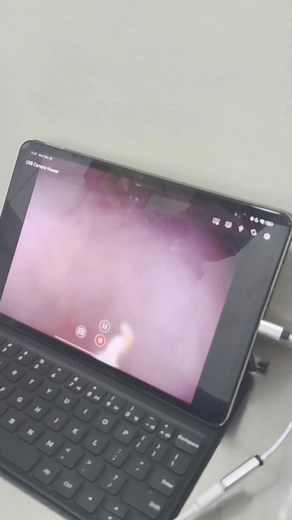 Why Bones Are Not Safe for Dogs Today we handled another foreign body obstruction (FBO) case caused by bone fragments. While many believe bones are “natural treats,” they can splinter easily and lead to serious problems such as: • Intestinal blockage • Choking • Tooth fractures • Internal injuries or perforation Even cooked bones can become sharp and dangerous. Keep your pets safe — avoid giving bones and choose safer chew alternatives instead. 🐶 | Petwell Animal Clinic - Magalang