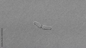 Fission yeast (Schizosaccharomyces pombe) reproduction under microscope